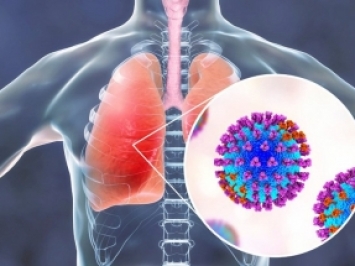 Đặc điểm tổn thương phổi do COVID-19 trên hình ảnh X-quang và cắt lớp vi tính